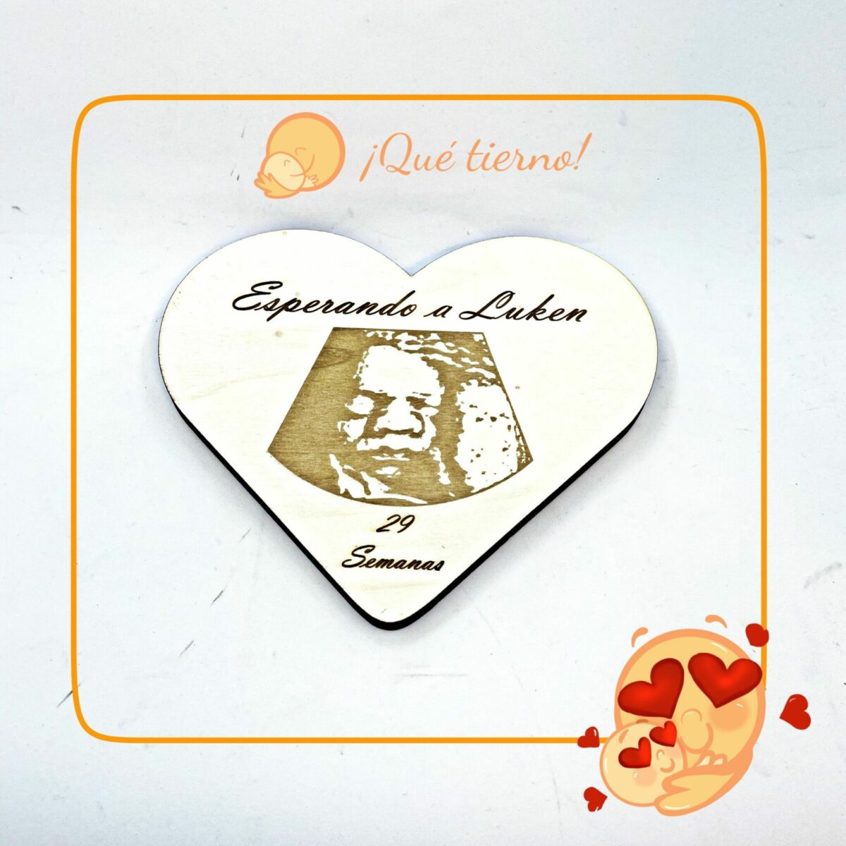 ecografía en corazón